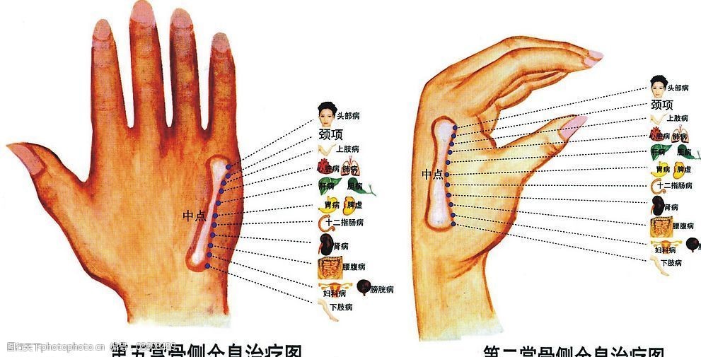 手掌反射区全息治疗图图片